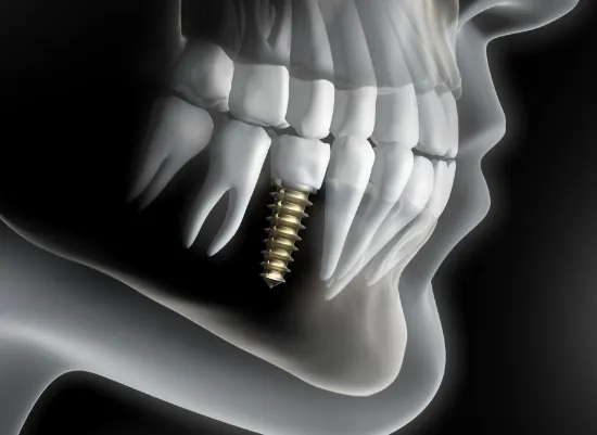 A patient during a comfortable restorative dentistry appointment